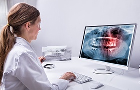 Dentist looking at digital dental x-rays