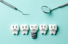Illustration of dental implant in New Bedford